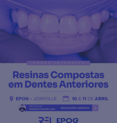 Resinas Compostas em Dentes Anteriores