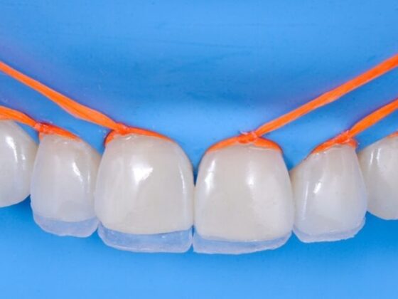 CURSO INTENSIVO EM RESINAS COMPOSTAS EM DENTES ANTERIORES